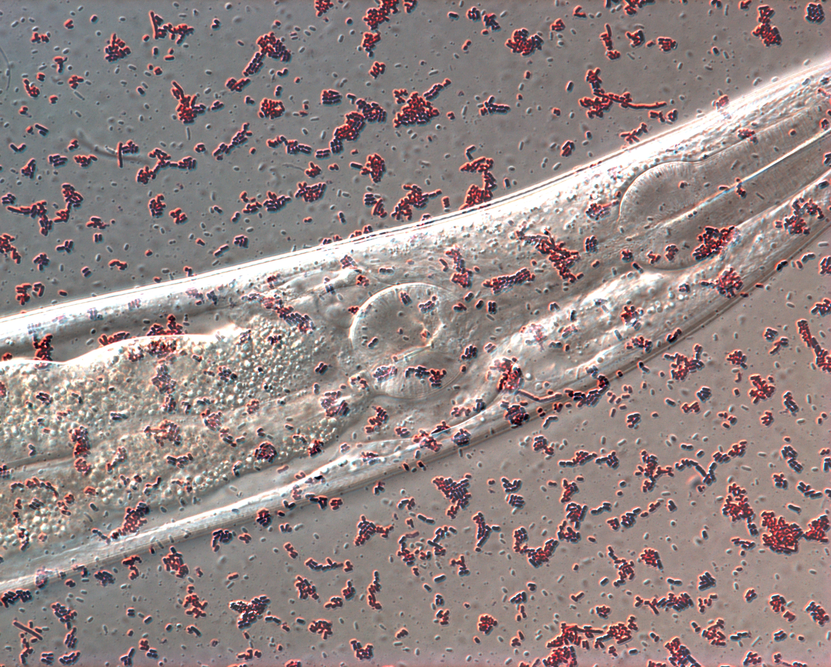 Diet found to affect learning in older nematodes